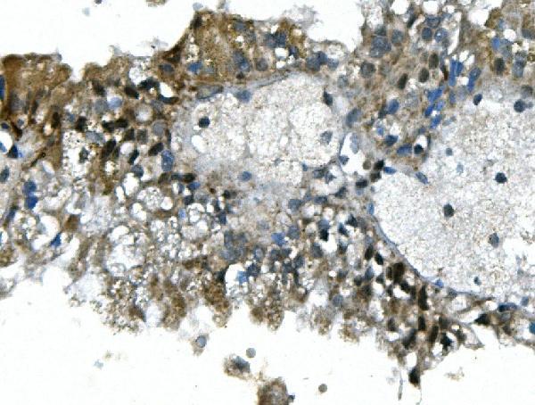  IHC analysis of UBR2 using anti-UBR2 antibody (A05812-2)
