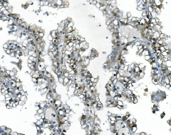 a05812 2 ubr2 primary antibodies ihc testing 4