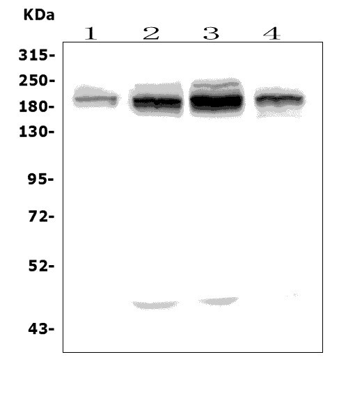  Western blot analysis of UBR2 using anti-UBR2 antibody (A05812-2)
