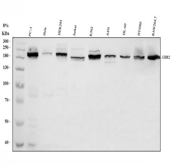 Western blot analysis of UBR2 using anti-UBR2 antibody (A05812-2)