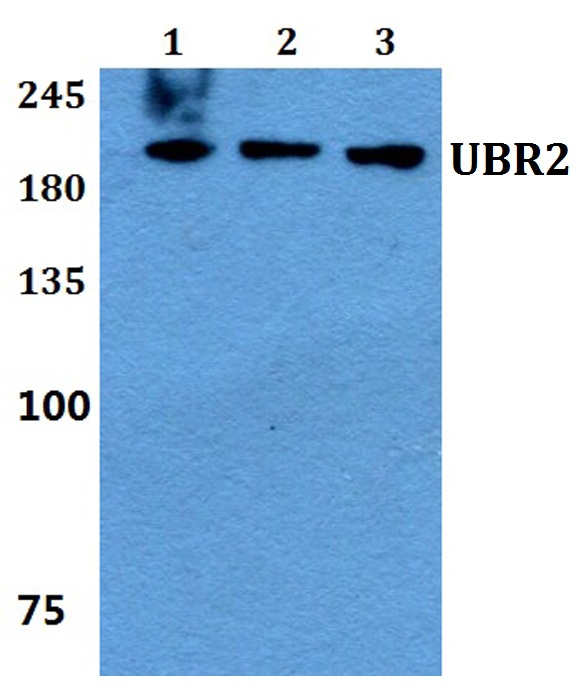 a05812 ubr2 primary antiboties wb testing 1