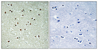 Immunohistochemical analysis of paraffin-embedded Human brain