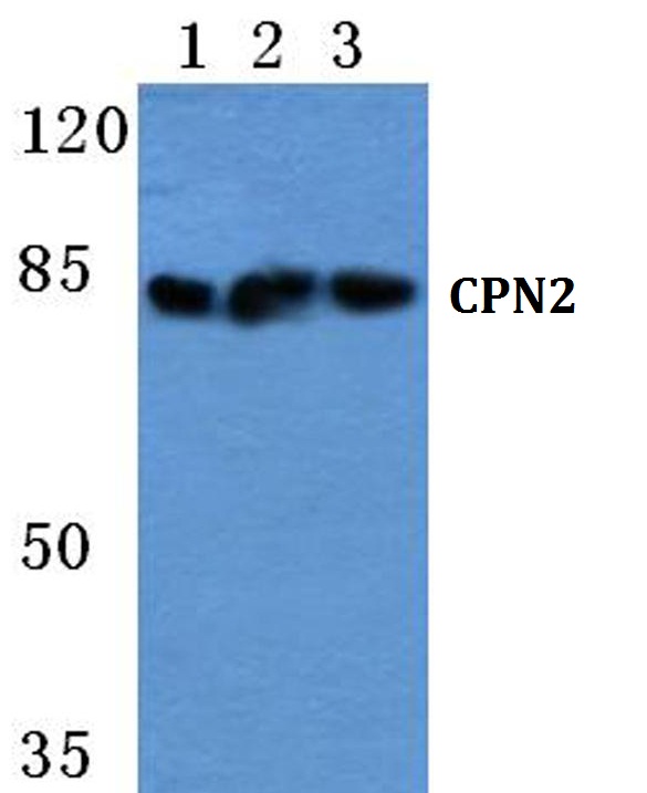 Western blot (WB) analysis of CPN2 polyclonal antibody at 1:500 dilution
Lane1:MCF-7 cell lysate
Lane2:Hela cell lysate
Lane3:Raw264