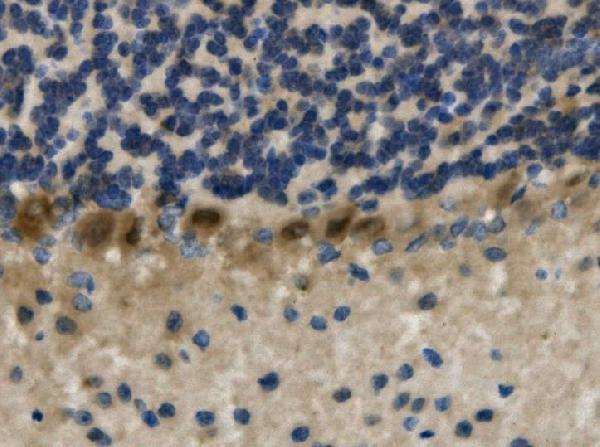  IHC analysis of LHX1 using anti-LHX1 antibody (A05816-1)