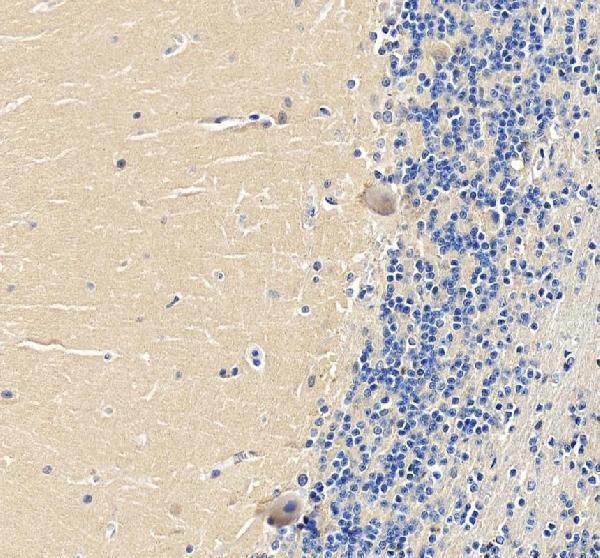 IHC analysis of LHX1 using anti-LHX1 antibody (A05816-1)