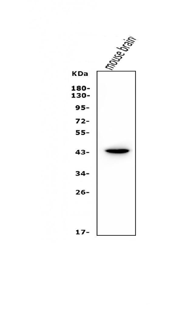  Western blot analysis of LHX1 using anti-LHX1 antibody (A05816-1)