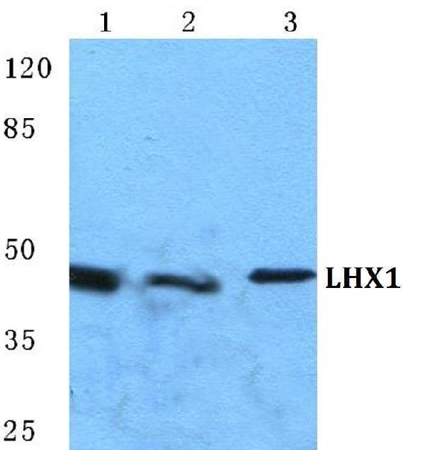 Western blot (WB) analysis of LHX1 polyclonal antibody at 1:500 dilution
Lane1:HEK293T cell lysate
Lane2:sp2/0 cell lysate
Lane3:H9C2 cell lysate