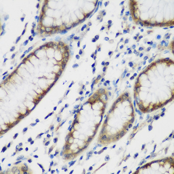 a05821 1 ttbk2 primary antiboties ihc testing 2