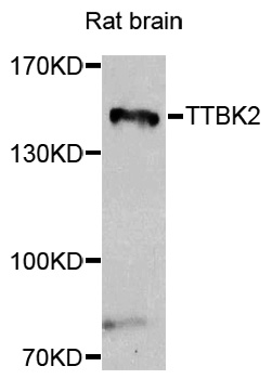 a05821 1 ttbk2 primary antiboties wb testing 1