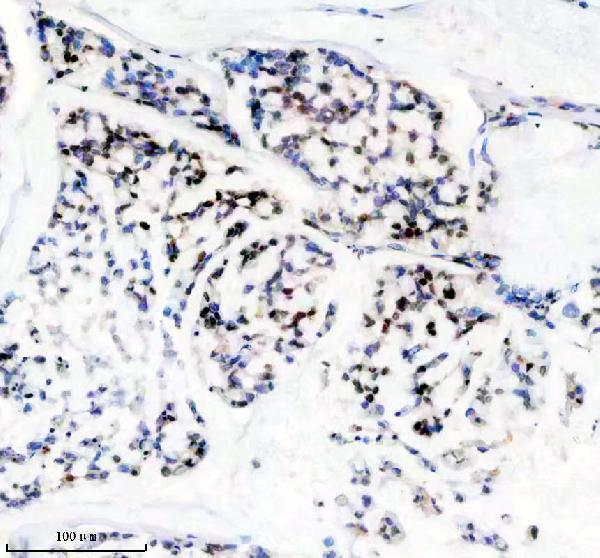 IHC analysis of ANP32B using anti-ANP32B antibody (A05822-1)