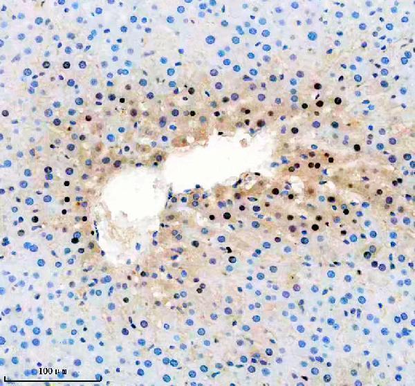 a05822 1 anp32b primary antibodies ihc testing 10