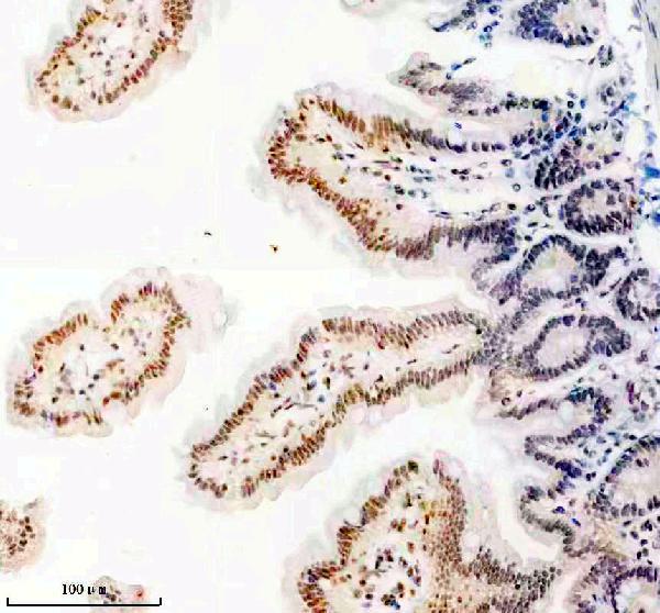 a05822 1 anp32b primary antibodies ihc testing 11