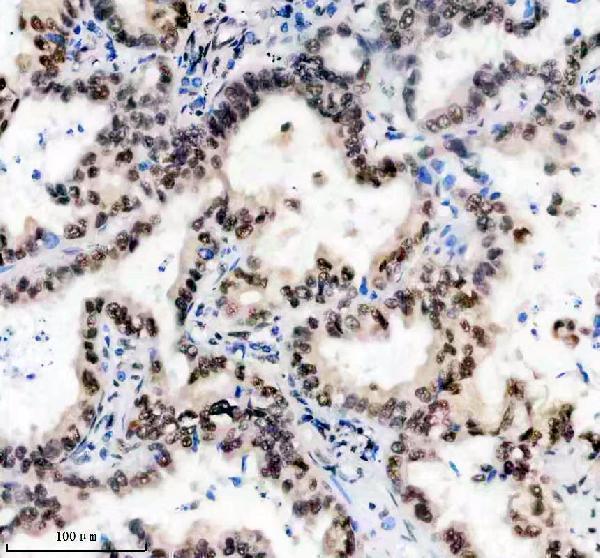 IHC analysis of ANP32B using anti-ANP32B antibody (A05822-1)