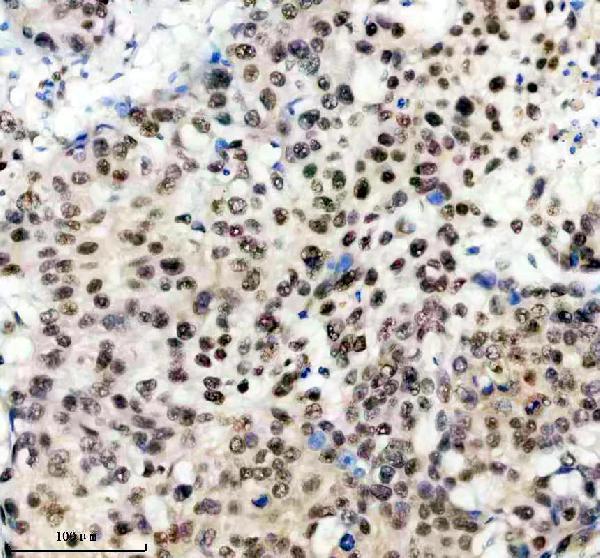 IHC analysis of ANP32B using anti-ANP32B antibody (A05822-1)