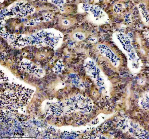 a05822 1 anp32b primary antibodies ihc testing 4