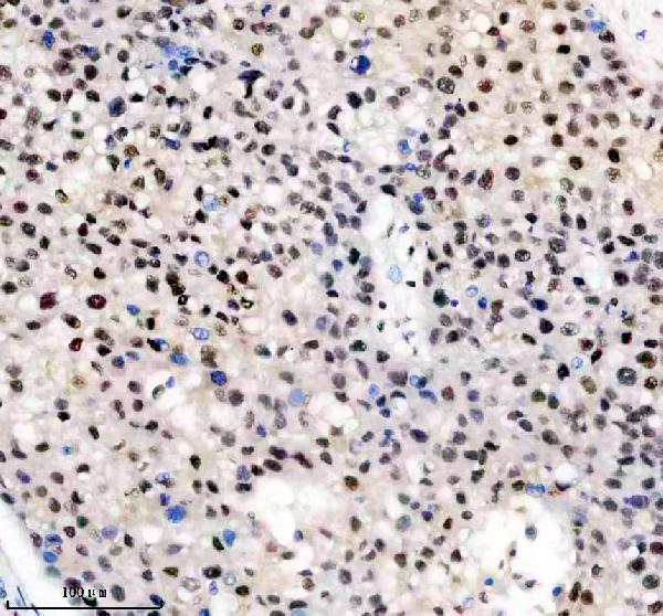 a05822 1 anp32b primary antibodies ihc testing 5