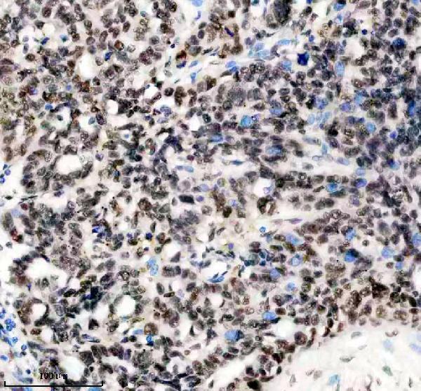 a05822 1 anp32b primary antibodies ihc testing 6