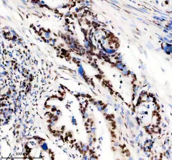 a05822 1 anp32b primary antibodies ihc testing 7