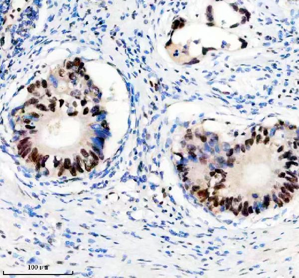 a05822 1 anp32b primary antibodies ihc testing 8