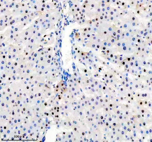 a05822 1 anp32b primary antibodies ihc testing 9