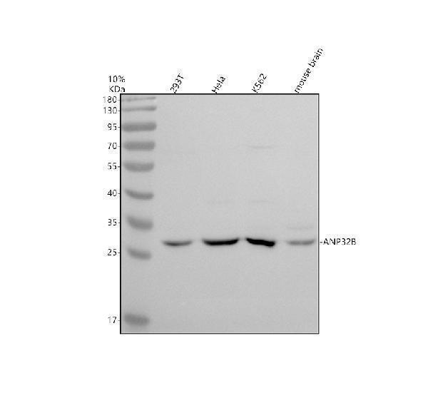 a05822 1 anp32b primary antibodies wb testing 1