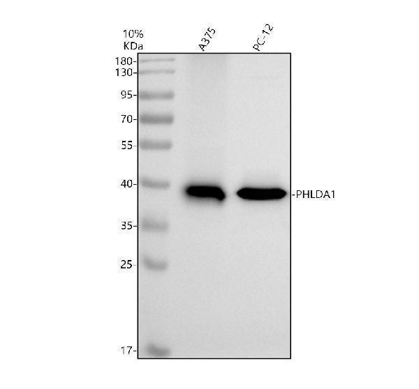 Western blot analysis of PHLDA1 using anti-PHLDA1 antibody (A05823-1)
