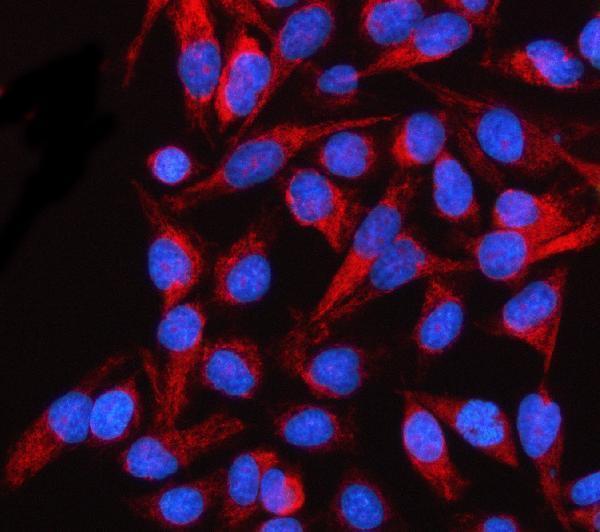  IF analysis of SLC38A9 using anti-SLC38A9 antibody (A05824-2)