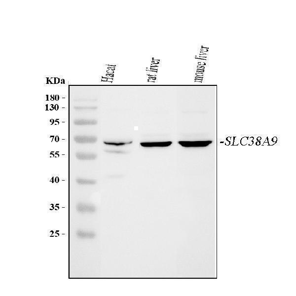  Western blot analysis of SLC38A9 using anti-SLC38A9 antibody (A05824-2)