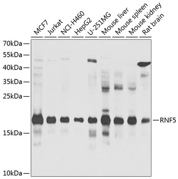 Western blot analysis of extracts of various cell lines, using RNF5 antibody  at 1:1000 dilution