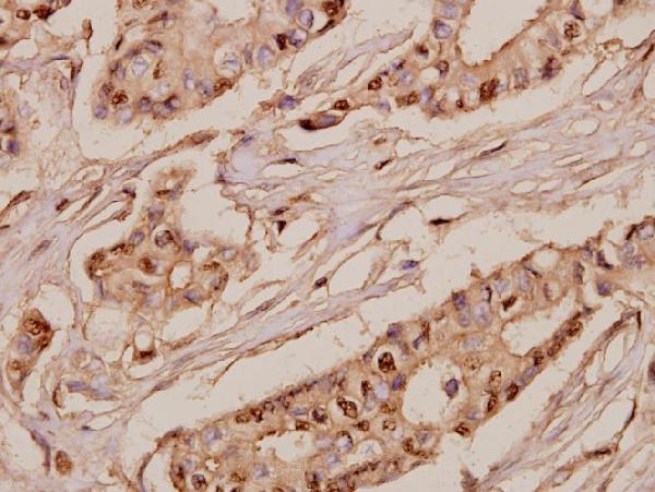 a05827 srsf7 primary antiboties ihc testing 2