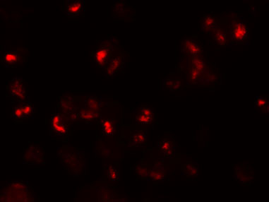 Immunofluorescence of SLAMF3 in 293 cells with SLAMF3 antibody at 20 μg/mL