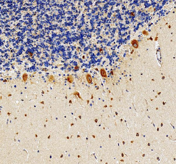 IHC analysis of RPS17 using anti-RPS17 antibody (A05831-1)