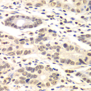 a05832 ccnc primary antiboties ihc testing 4