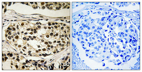 Immunohistochemistry validation of CCNC using Anti-Phospho-Cyclin C (S275) CCNC Antibody (A05832S275)