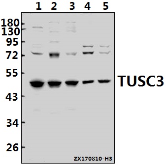 Western blot (WB) analysis of TUSC3 (H153) pAb at 1:500 dilution
Lane1:PC3 whole cell lysate(40ug)
Lane2:L02 whole cell lysate(40ug)
Lane3:A549 whole cell lysate(40ug)
Lane4:H9C2 whole cell lysate(40ug)
Lane5:CT26 whole cell lysate(40ug)