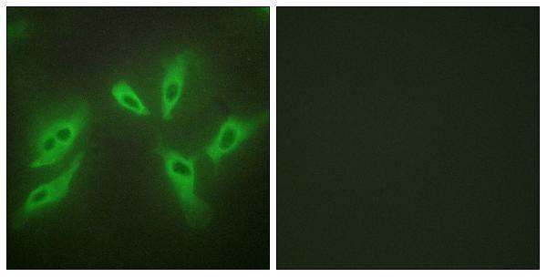 Immunofluorescence analysis of HeLa cells using TUSC3 Antibody
