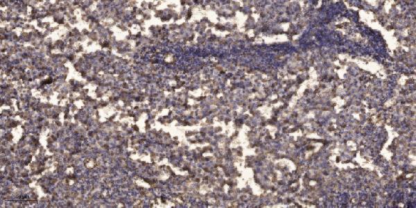 a05834 tusc3 primary antibodies ihc testing 4