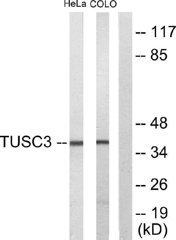 Western blot analysis of lysates from COLO205 and HeLa cells, using TUSC3 Antibody