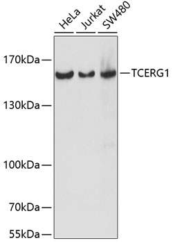a05835 tcerg1 primary antiboties wb testing 1