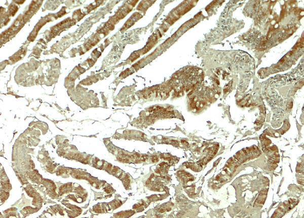 a05836 wnt5b primary antibodies ihc testing 2