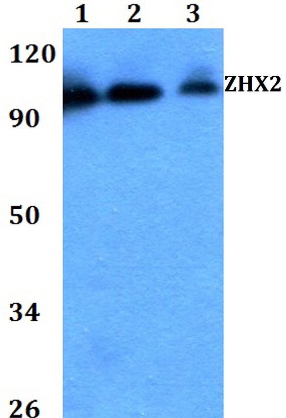 Western blot (WB) analysis of ZHX2 polyclonal antibody at 1:500 dilution
Lane1:HEK293T whole cell lysate
Lane2:Raw264