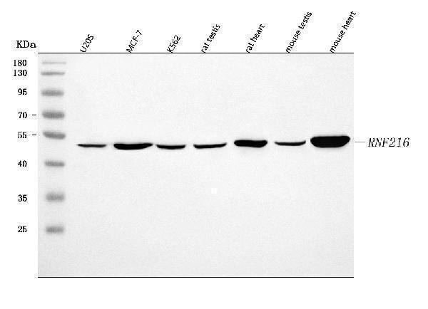  Western blot analysis of RNF216 using anti-RNF216 antibody (A05841-1)