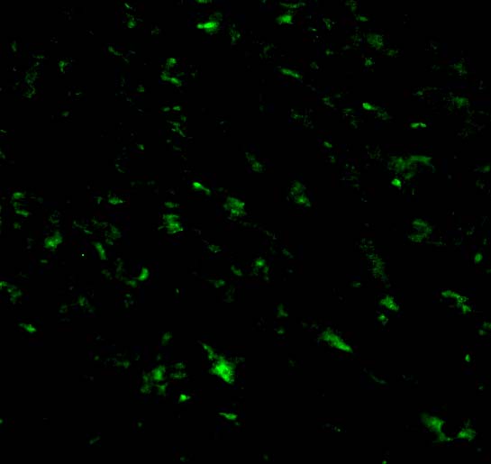 Immunofluorescence of TRIAD3A in Mouse Heart cells with TRIAD3A antibody at 20 μg/mL