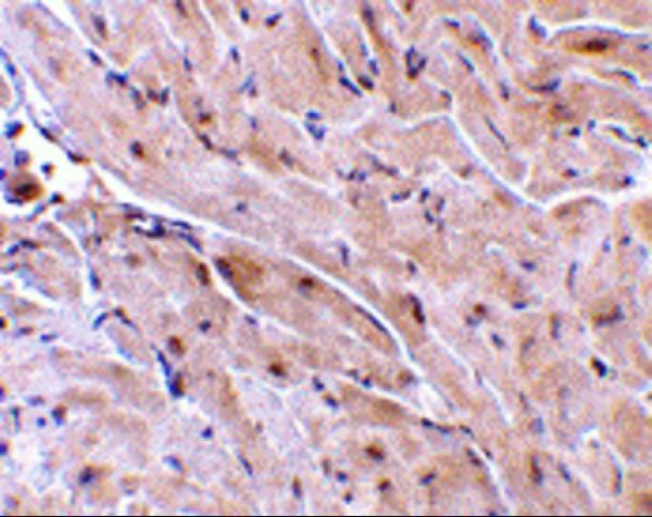 Immunohistochemistry of TRIAD3A in mouse heart with TRIAD3A antibody at 10 μg/mL