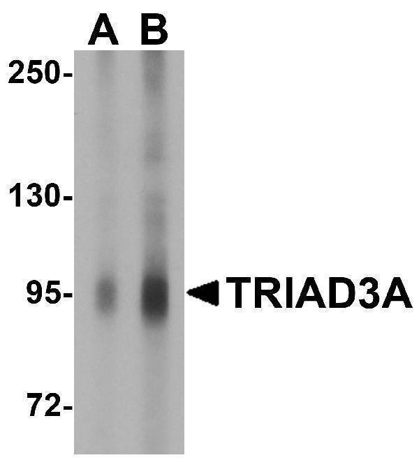 Western blot analysis of TRIAD3A in mouse heart tissue lysate with TRIAD3A antibody at (A) 1 and (B) 2 μg/mL
