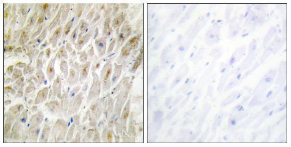 a05844 1 dlx3 primary antibodies ihc testing 1