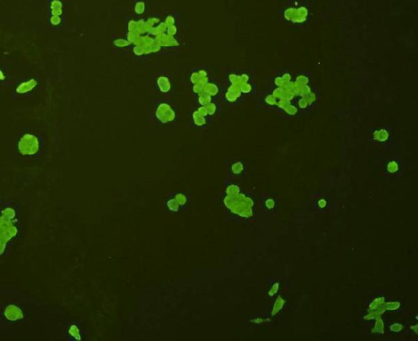 ICC staining p70 S6 Kinase beta in Lovo cells (green)