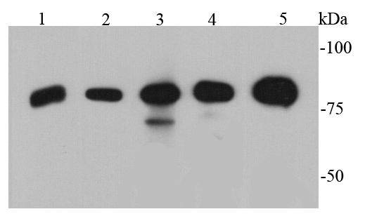 Western blot analysis of p70 S6 Kinase beta on different cell lysates using anti-p70 S6 Kinase beta antibody at 1/500 dilution