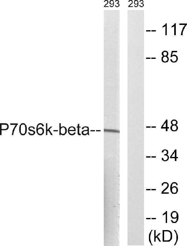 a05845 rps6kb2 primary antibodies wb testing 4
