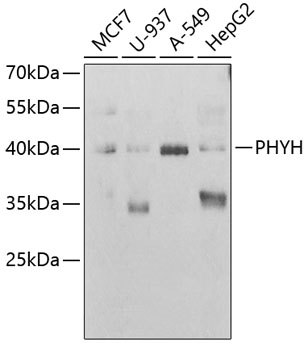 a05846 phyh primary antiboties wb testing 1